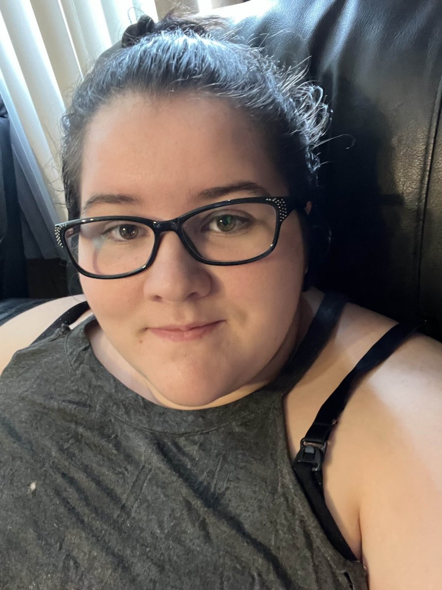 Before surgery 
