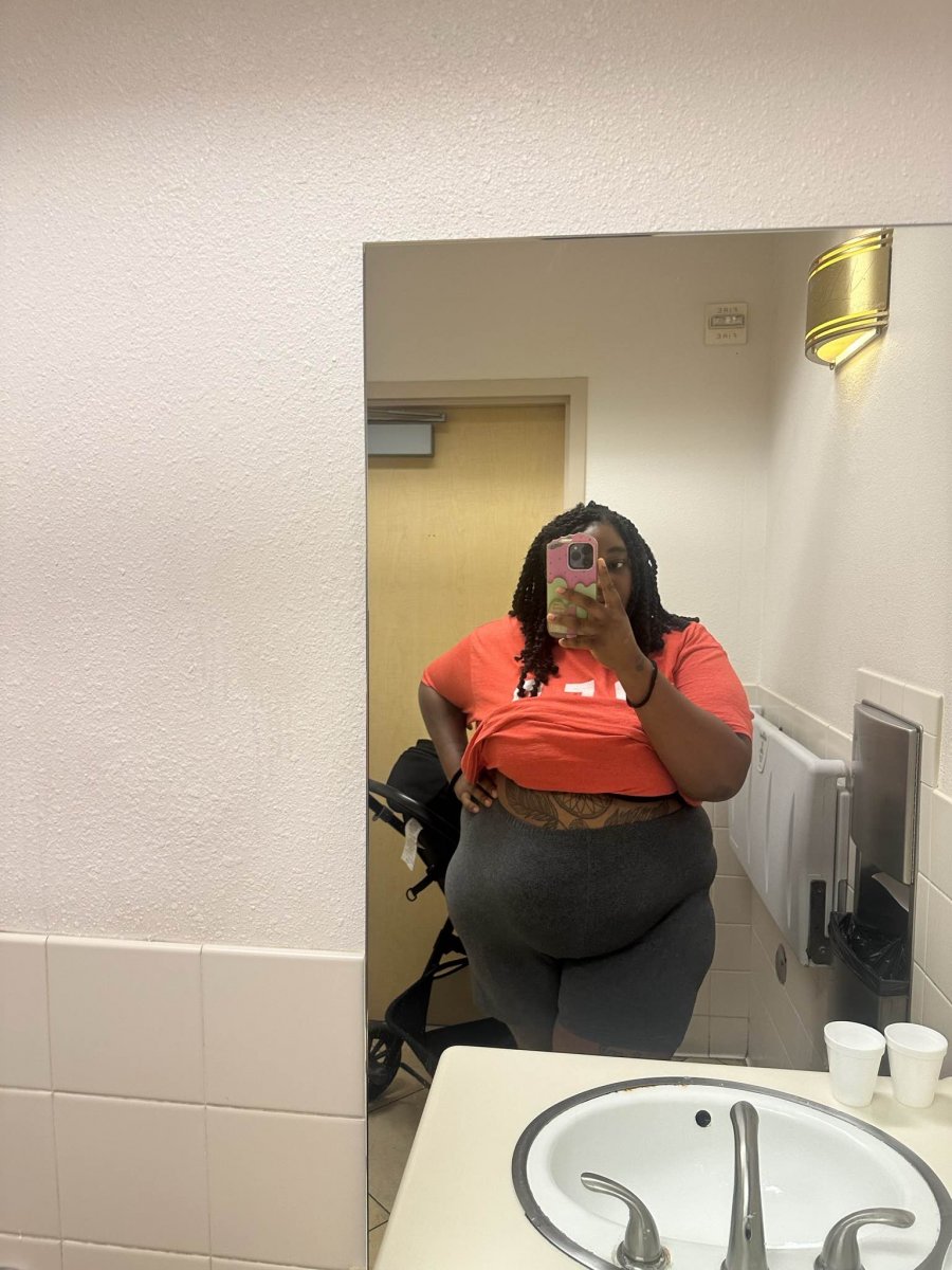 14 days before surgery