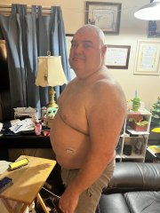 Night before surgery 