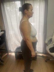 1 month after surgery.JPG