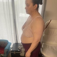 before surgery.JPG
