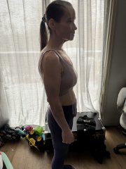 6 months after surgery.jpg