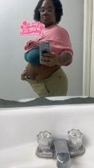 Pre surgery 