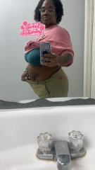 Pre surgery 