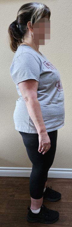 Before side
